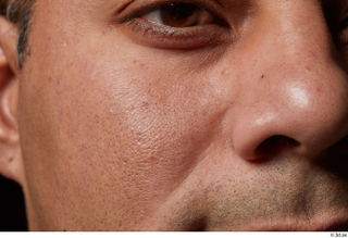 HD Face Skin Gabriel Ros cheek face nose skin pores…
